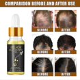 thumbnail image 3 of Hair Care Essential Oil Wel, 3 of 4