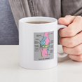 thumbnail image 4 of CafePress - Knee Joint Mug - 11 oz Ceramic Mug - Novelty Coffee Tea Cup, 4 of 4