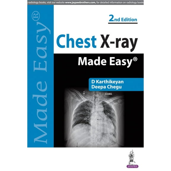 Chest X-ray Made Easy (Paperback)