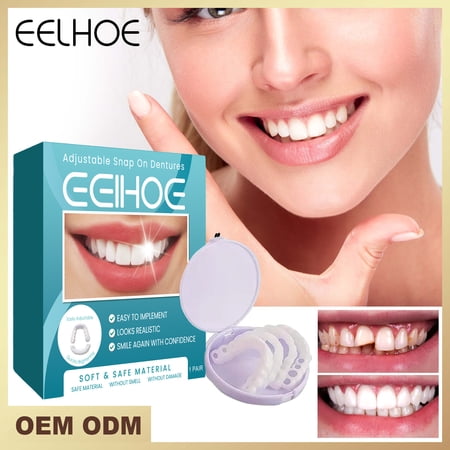 Eelhoe Adjustable Snap Dentures Temporary Fillings Interdental Fillings Orthodontic Dentures Kit, 1Pcs