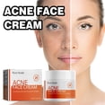 thumbnail image 4 of Fiudx Crema Facial, Fórmula Salicílica Avanzada, Loción Hidratante Suave, Solución Natural Antiimperfecciones, Cuidad Facial Diario, Aprobado para Pie Sensible, Recomendado Por Dermatólogos., 4 of 7