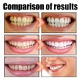 thumbnail image 4 of Coconut Pulling Oil, Mint Oil Pulling Mouthwash, Oil Pulling for Healthy Teeth & Gums, Whitening Pulling Oil Coconut Mint, Mouthwash With Tongue Scrap, 4 of 5