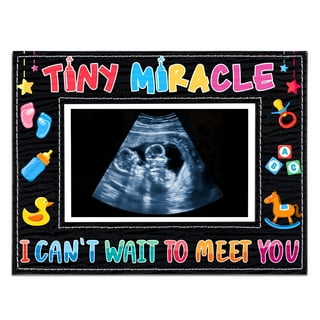  trlry Triple Ultrasound Picture Frames, Sonogram Picture Frame  3 Photos,Pregnancy Announcements,Pregnancy Gifts for First Time Moms,First  Time Mom Gift,White,Ultrasound Photo Album : Baby