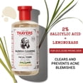 thumbnail image 3 of Thayers Witch Hazel Aloe Vera Formula Astringent, Lemon 12 oz, 3 of 7