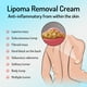 thumbnail image 5 of Eliminación de lipomas,Crema de eliminación de lipoma de 20 g Crema para disolver grasa,Ungüento de eliminación de bultos de grasa removedor de lipoma,Crema de eliminación de lipoma para Jinwen Eliminación de lipomas, 5 of 8