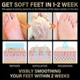 thumbnail image 4 of Jaysuing 2 Pairs Lavender Exfoliating Foot Mask Moisturizing Hydrating Remove Dead Skin Foot Pad |, 4 of 4