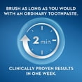 thumbnail image 2 of Pasta de dientes Crest Pro-Health Gum Detoxify + Whitening 120 ml, 2 of 9