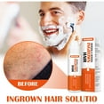 Ssdyl Essence Clearance Care Shave Burns For Ingrowns The Hair For