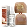 thumbnail image 1 of Fungal Nail Care Serum Thick Nail Soft Nail Repair Essence Lotion Toe Whitening Treatment Care, 1 of 3