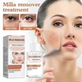 thumbnail image 1 of Éliminateur de Milium - Dissout & Réduit Milium, Whitehead, Hyperplasia Sébacé - 30ml, 1 of 5