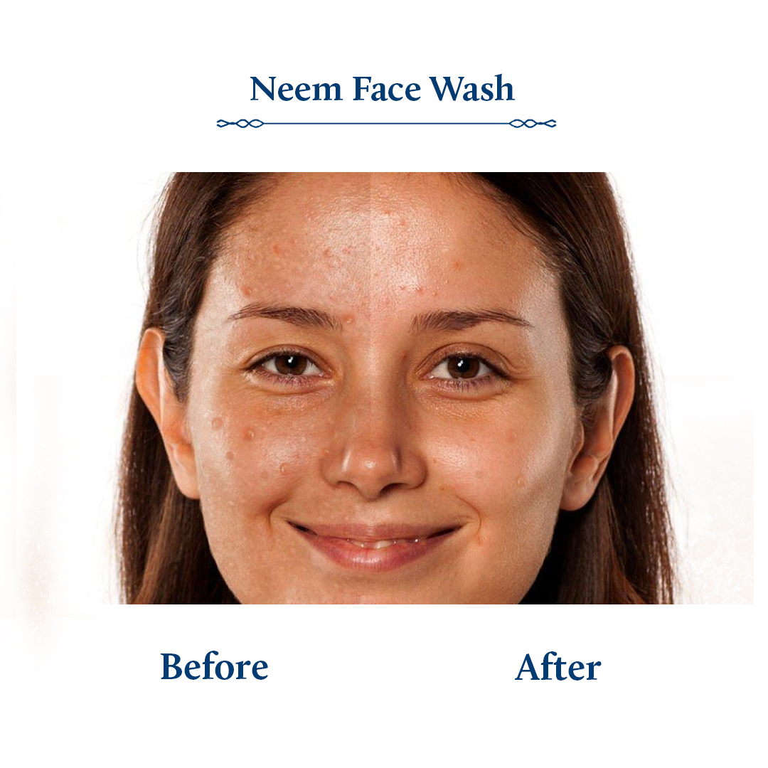 Blue Nectar Shubhr Neem Face Cleanser
