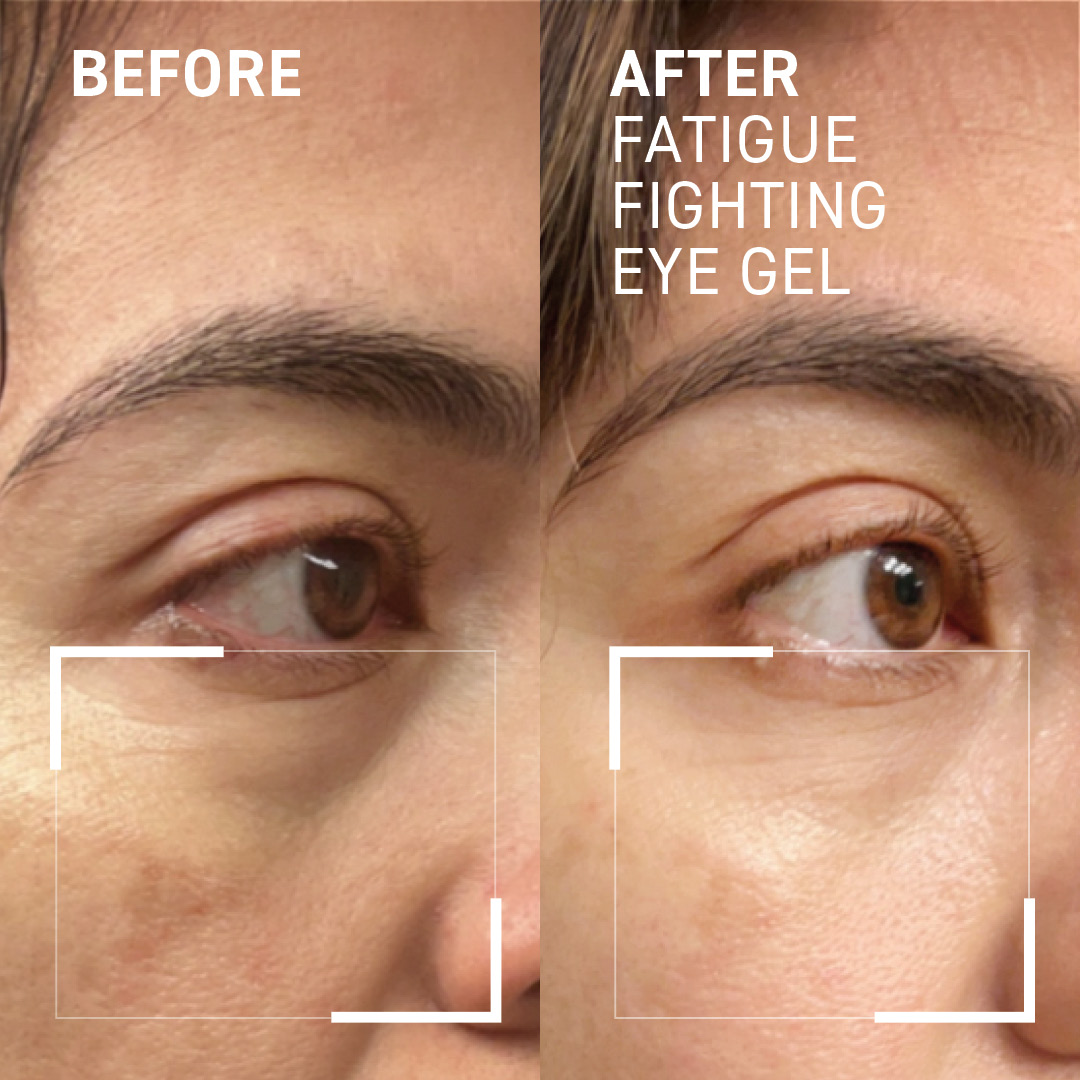 Dr Brandt iD-stress Fatigue Fighting Eye Gel