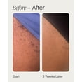 thumbnail image 2 of Calming Ingrown Hair Solution | Gentle Roll-on Formula for Sensitive Skin & Post-Shaving Care, 2 of 5