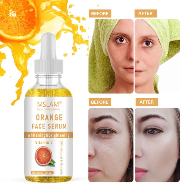 Xihbxyly Suero de Fresa Dorada, Aceite Nutritivo para Una Piel Luminosa, Fórmula Antiedad Que Reduce Las Líneas de Expresión, Tratamiento Hidratante para Piel Seca, Ideal para Todo Tipo de Piel, Tama