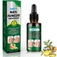 thumbnail image 1 of Ginger Nail Fungus Treatment Extra Strength, Anti Fungal Nail Treatment for Toenails and Fingernails, Toenail Fungal Treatment for Nail Repair, 1 of 5