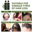 thumbnail image 4 of Champú Tgideas Organic Rosemary para crecimiento del cabello, 220 ml, para mujeres y hombres, 4 of 9