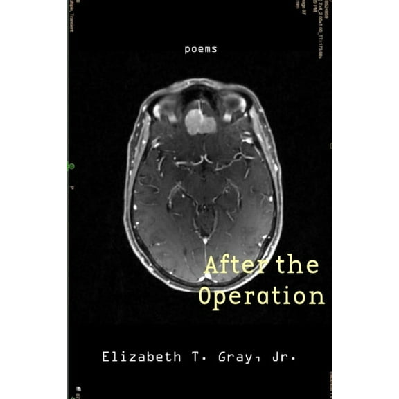 After the Operation, (Paperback)