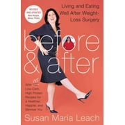 Before & After, Second Revised Edition: Living and Eating Well After Weight-Loss Surgery, Used [Paperback]