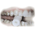 thumbnail image 3 of Dentsply - Chewing-Gums pour Gouttières (20 Chewing-Gums Ananas par Sachet), 3 of 3
