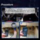 thumbnail image 2 of T200 OBD2 Scanner Vehicle Code Reader Scanner Diagnostic Tools, 2 of 4