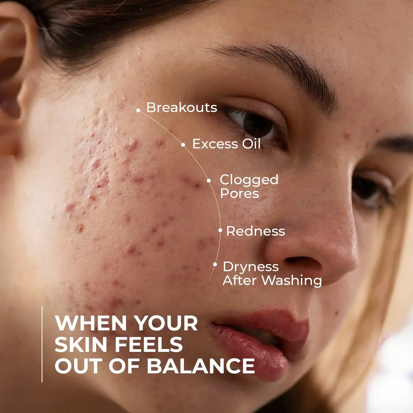Skin Centrick Acne Face Cleanser with Niacinamide, Clay and Salicylic Acid, Oil Control Face Wash