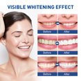 thumbnail image 4 of Ashosteey Teeth Whitening Pen,No Sensitivity Teeth Whitening Gel, Effective Teeth Whitener, Travel-Friendly Tooth Whitening Pen, Carbamide Peroxide Tooth Bleaching Gel for Adults,White Smile, 4 of 9