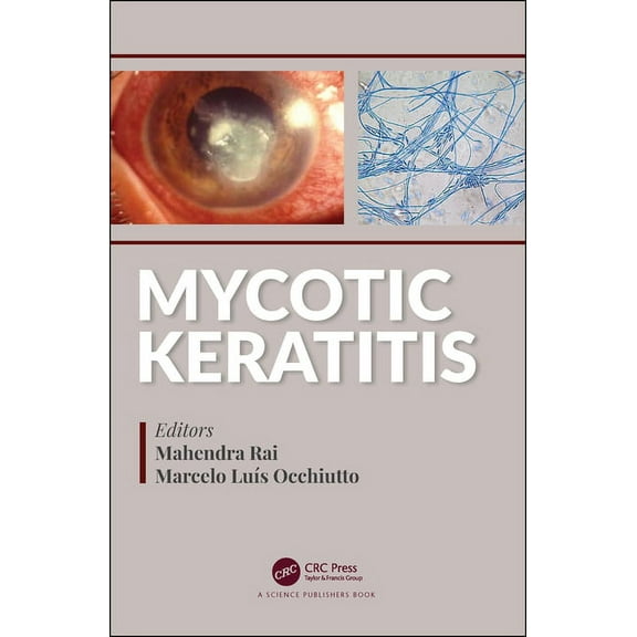 Mycotic Keratitis, (Hardcover)