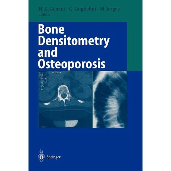 Bone Densitometry and Osteoporosis, (Paperback)