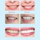 thumbnail image 4 of Blanqueamiento de instantáneo de Blanqueamiento de blanqueador Eliminar atención bucal Macarena Pluma de blanqueamiento dental, 4 of 5