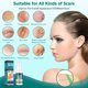 thumbnail image 3 of Gel para cicatrices Gowgaw Advance para cicatrices quirúrgicas, 50 ml, para mujeres y hombres, 3 of 7