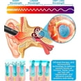 thumbnail image 5 of Dispositivo de alivio de tinnitus, pluma térmica para tratamiento nervioso de tinnitus, dispositivo de soporte auditivo para el cuidado del oído de tinnitus Im, 5 of 5