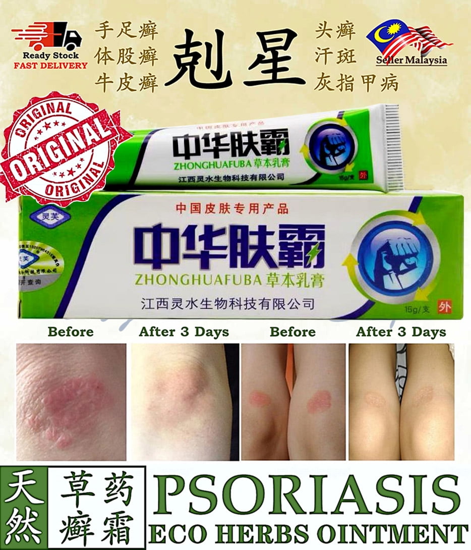Buy Natural Chinese Herbal Medicine Psoriasis Cream Eczema Ointment