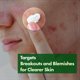 thumbnail image 2 of Crema hidratante TOSOWOONG Madagascar Centella 50 ml, 2 of 6