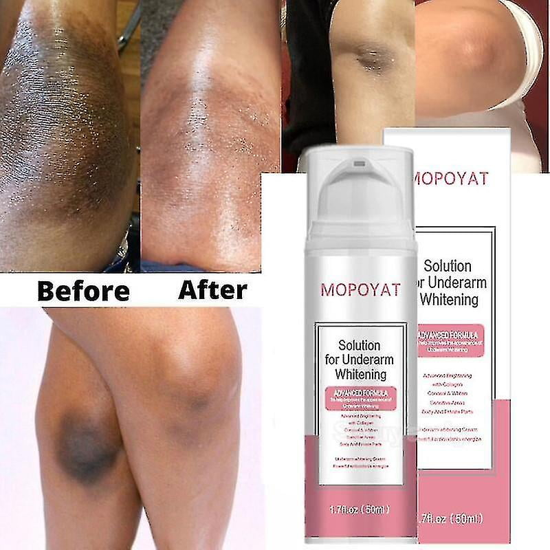 Axilas Oscuras Clinica Para Blanquear La Piel Blanqueamiento