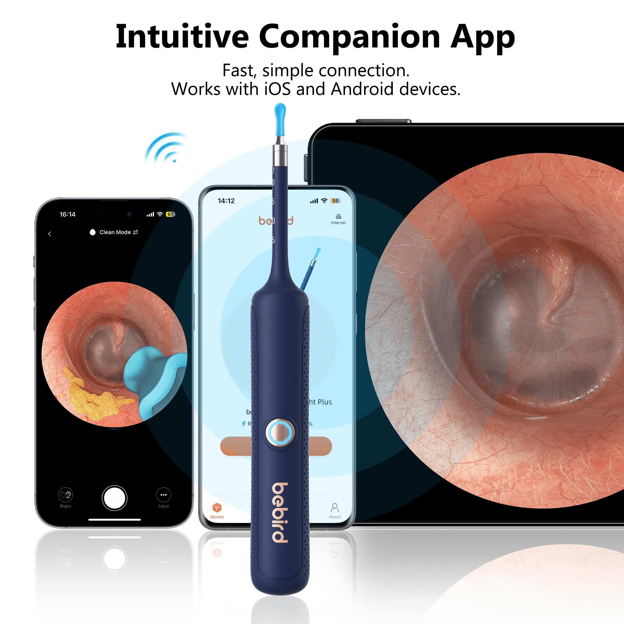 Bebird Max 22 Ear Wax Remover