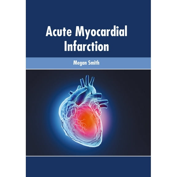 Acute Myocardial Infarction, (Hardcover)