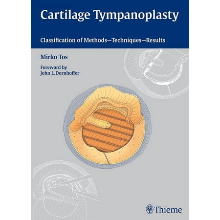UPC: 9783131450913 | Cartilage Tympanoplasty: Classification of Methods – Techniques – Results (Hardcover)