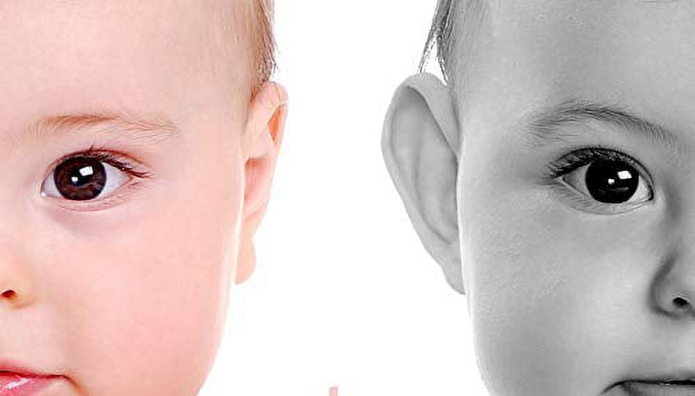 Otostick Correctores estéticos para orejas prominentes, contiene 8  correctores y 1 gorra, más de 3 meses