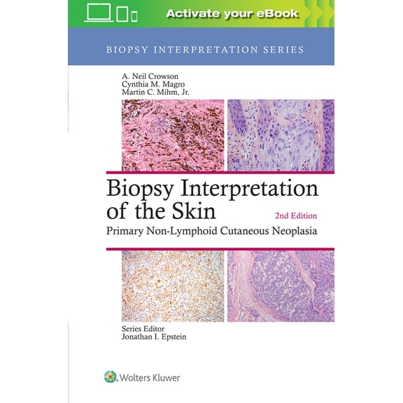 Biopsy Interpretation: Biopsy Interpretation of the Skin: Primary Non-Lymphoid Cutaneous Neoplasia (Hardcover)
