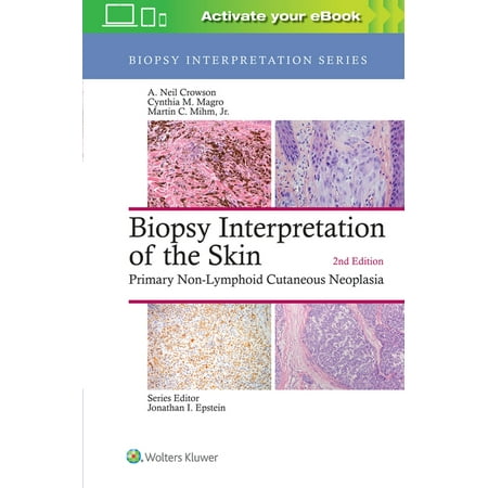 UPC: 9781496365132 | Biopsy Interpretation: Biopsy Interpretation of the Skin: Primary Non-Lymphoid Cutaneous Neoplasia (Hardcover)