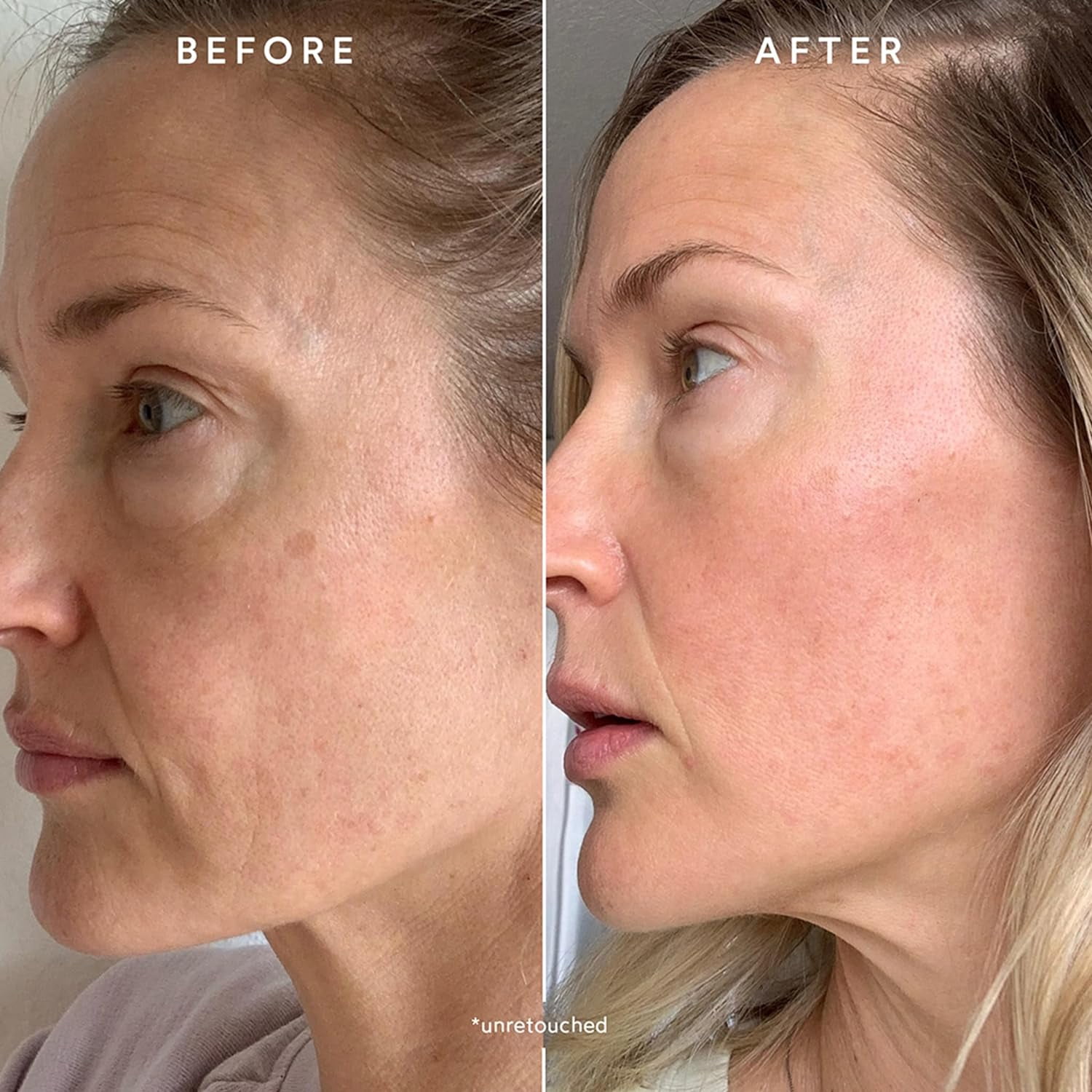 True Botanicals - Chebula Active Serum | Non-Toxic, Cruelty-Free | Anti-Aging Serum | Hyaluronic Acid | Targets Fine Lines & Wrinkles for All Skin Types | MADE Safe (1 fl oz | 30 ml)