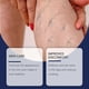 thumbnail image 3 of 1-6pcs SOUTH MOON Varicose Vein Care Cream 100g Swell Care Lymphatic Massage Cream for Swelling Reli, 3 of 5