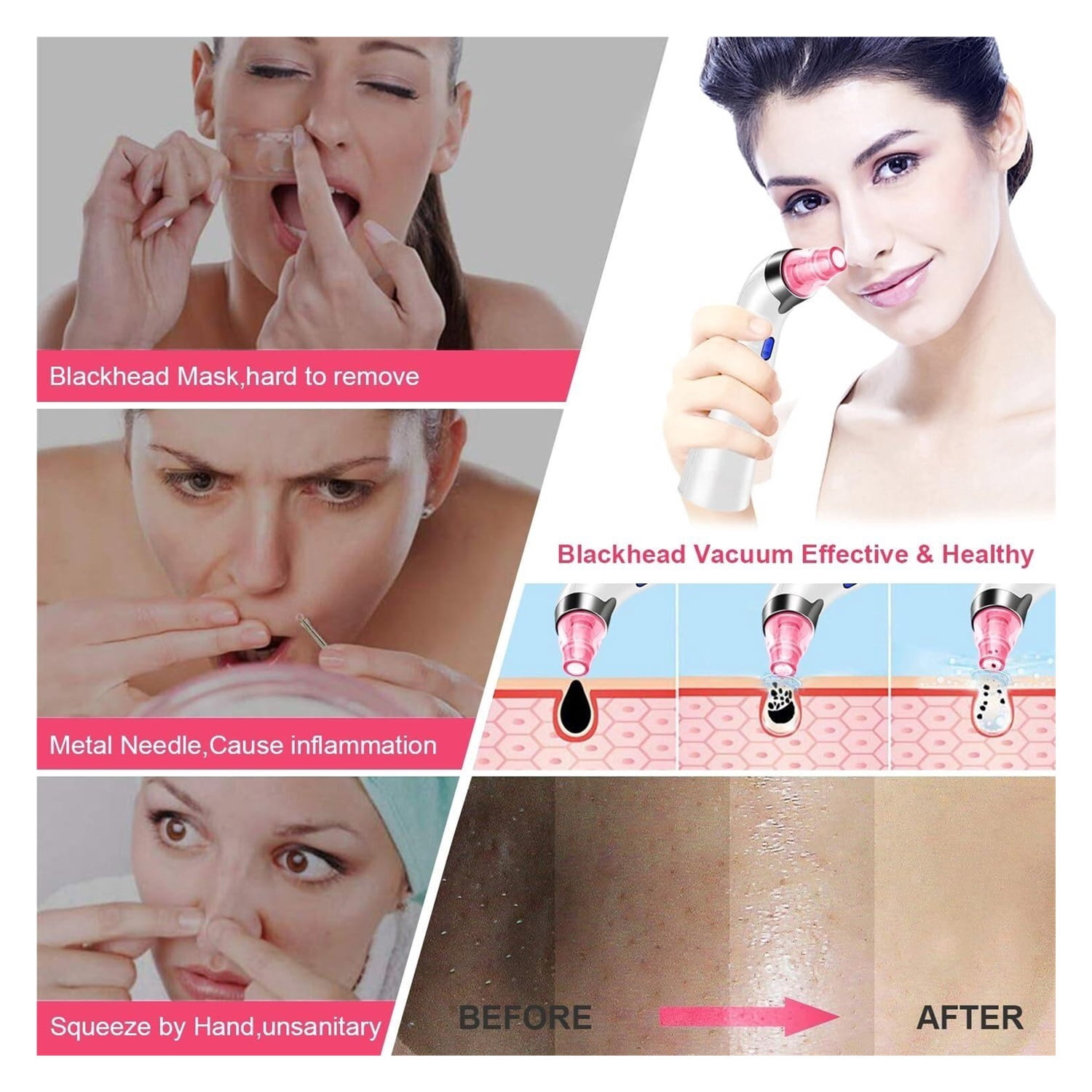 Blackhead Remover Pore Vacuum, Face Suction Pore Cleaner, 5 Suction Power Electric Blackhead Extractor Tool, 4 Probes, Blackhead Suction Remover for Women & Men