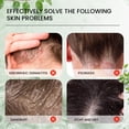 thumbnail image 4 of Sumifun Seborrheic Dermatitis Cream is designed specifically for seborrheic dermatitis. It helps to soothe skin discomfort, reduce inflammation, and provide deep hydration to improve skin condition., 4 of 5