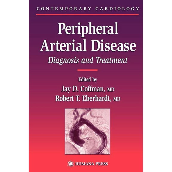 Contemporary Cardiology Peripheral Arterial Disease: Diagnosis and Treatment, (Hardcover)