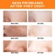 thumbnail image 5 of Fiudx Jabón de Cúrcuma, Ingredientes Naturales para Una Limpieza Profunda, Beneficios Hidratantes para Una Piel Suave, Propiedades Antiinflamatorias para Una Tez Más Saludable, Uso Facial y En La Duc, 5 of 6