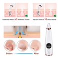 thumbnail image 3 of Facial Pore Blackhead Remover Vacuum, Electric Blackhead Extractor Deep Cleansing Machine for Men Women, 3 of 5