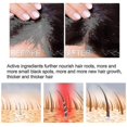 thumbnail image 2 of 50ml Hair Growing Spray Ginger King Anti-removal Spray Hair Raising Liquid Treatment Hair Loss, 2 of 5