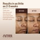 thumbnail image 4 of Crema facial Ambi Even & Clear Advanced para hiperpigmentación de 30 ml, 4 of 5