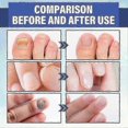thumbnail image 2 of Nail Repair Light Therapy Led Lamp Hand Foot Nails Yellow Soft Nail -, 2 of 5